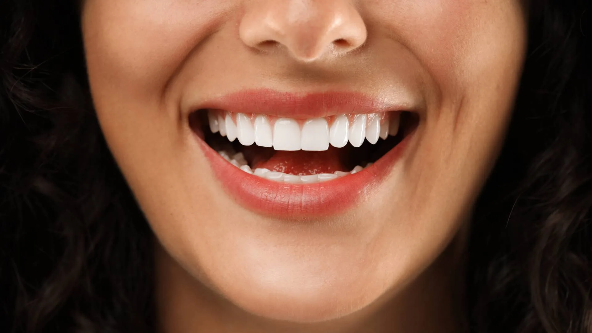 faccette dentali 2 | faccettadentale.it