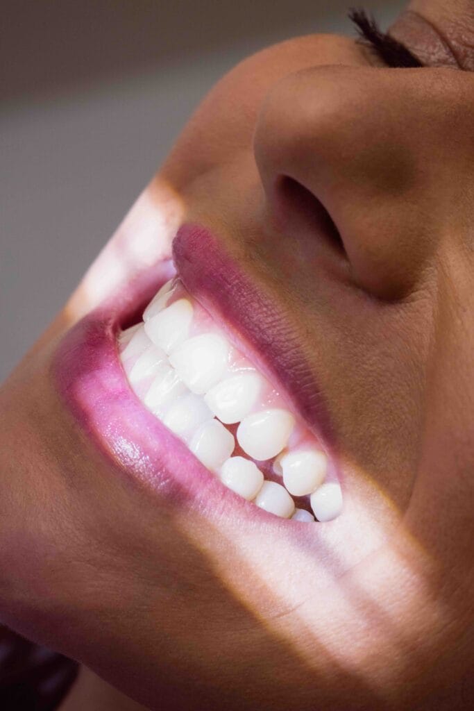 Quanto durano le faccette dentali