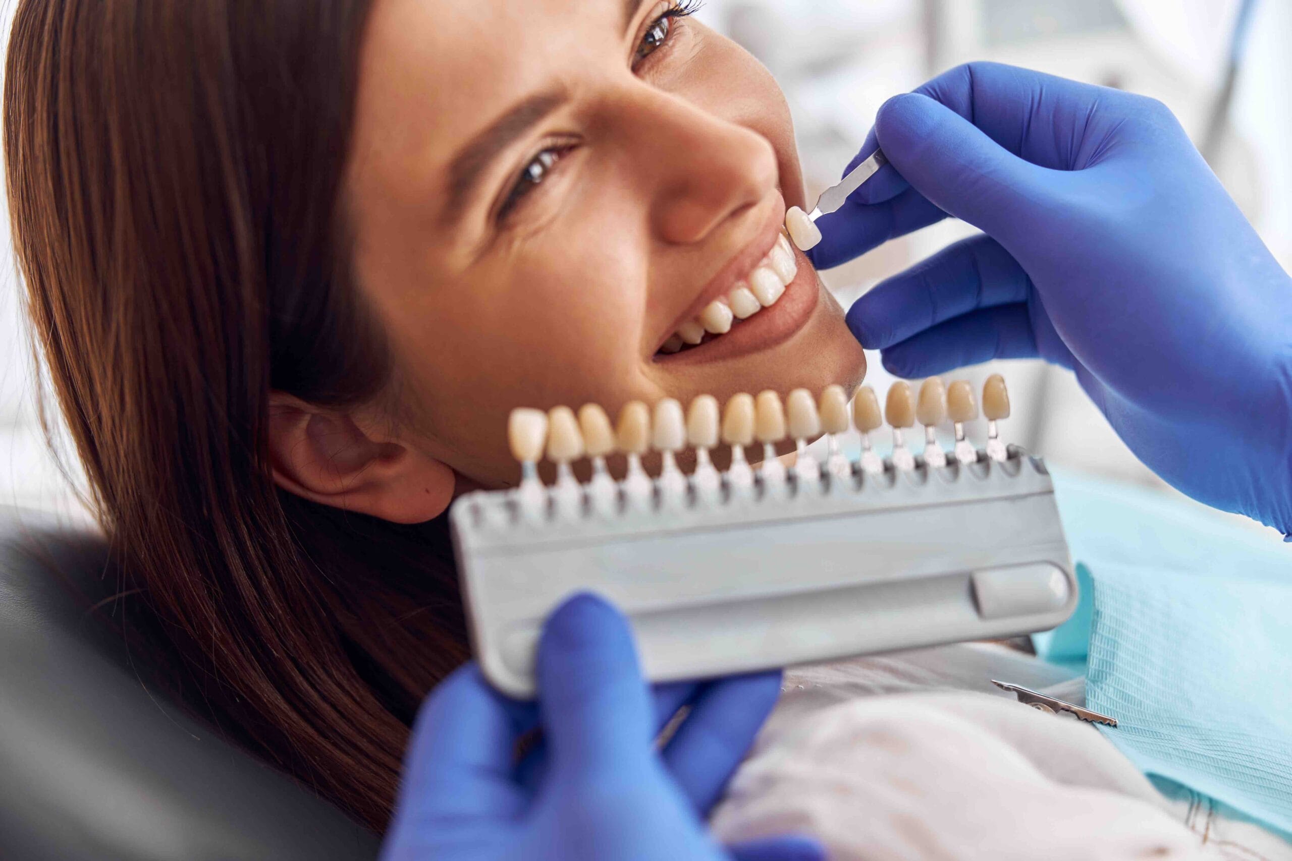 Quanto costa rifarsi i denti con faccette dentali