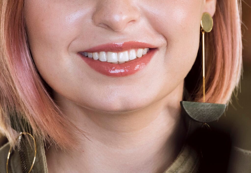 faccette o apparecchio per i denti storti?