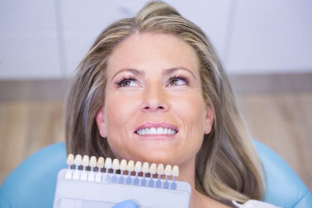 faccette dentali provvisorie