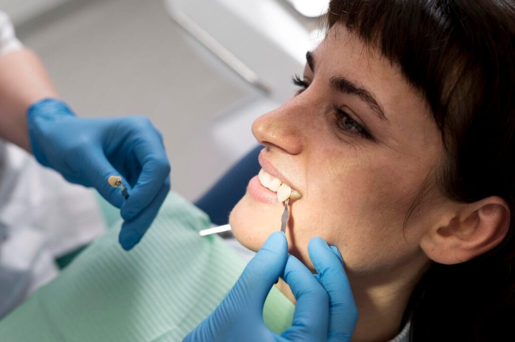faccette dentali cosa sono